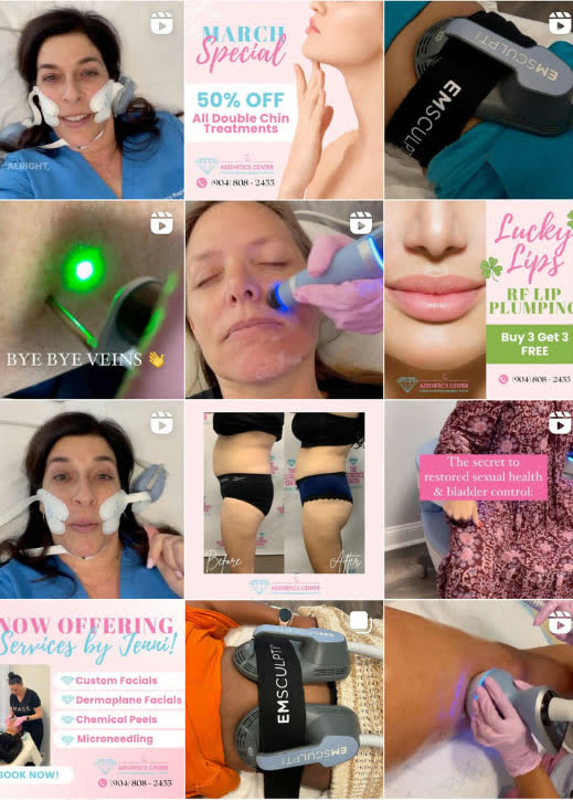The Aesthetics Center's Instagram grid before working with Synovial Marketing, twelve posts mixing discount offers and in-room treatment videos with clinical before and after photographs